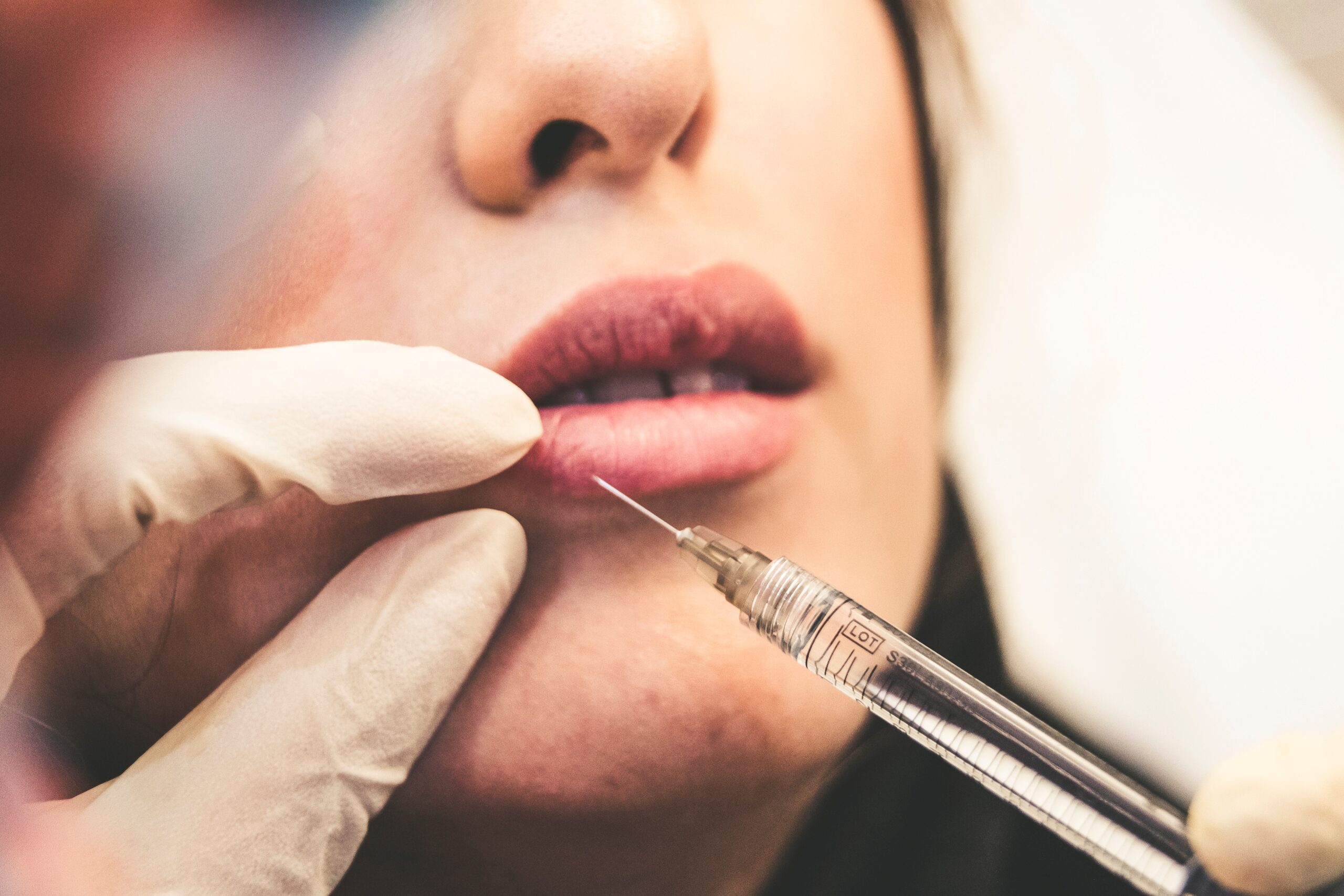 Lip Injections - Dr Joseph Franzese Talks About Juvederm